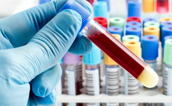 A close up of a hand holding a test tube containing blood/a red substance.