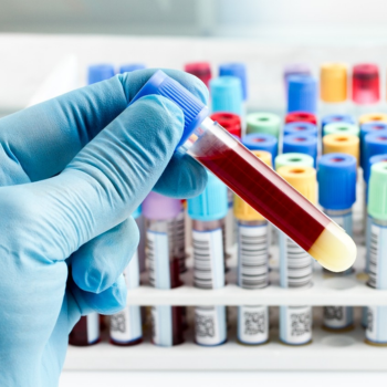 A close up of a hand holding a test tube containing blood/a red substance.